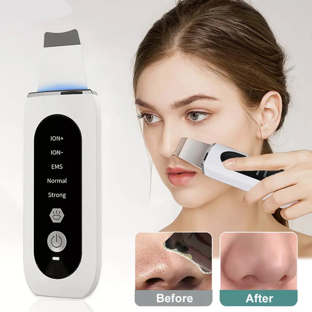 Ultrasonic Skin Scrubber: Peeling, Blackhead Remover & Tiefenreinigung - Raffiniertedinge Ultrasonic Skin Scrubber: Peeling, Blackhead Remover & Tiefenreinigung - Raffiniertedinge